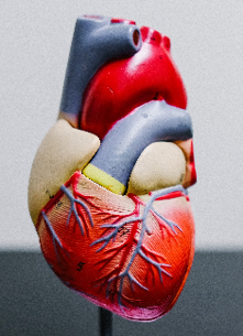 Topline SELECT Cardiovascular Outcomes Trial results drove cardiologist speculation about GLP-1 agonists as a potential alternative to PCSK9 inhibitors like Repatha and Praluent.